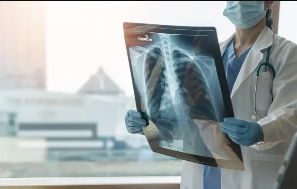 За три місяці у Полтавській області зафіксували майже сотню випадків туберкульозу