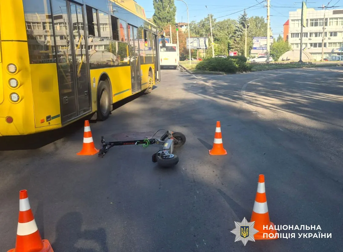 Неповнолітнього полтавця, який впав із електросамоката, госпіталізували в тяжкому стані